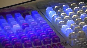 Contamination in water samples collected in San Diego County is revealed by a black light, March 10, 2015. 