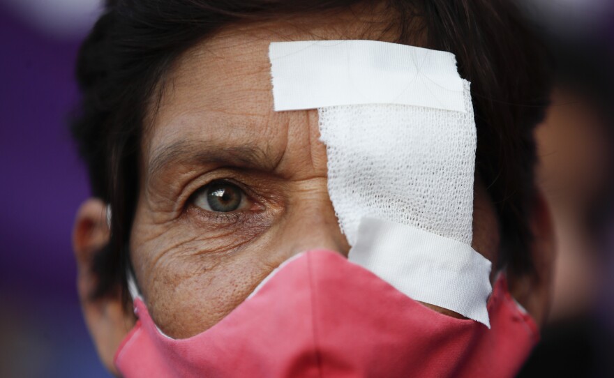 A woman has one eye covered to protest gender violence, in Buenos Aires, on Feb. 17, 2021. Women from the "Ni Una Menos" or "Not One Less" movement marched to protest what they say is the negligence of judges when it comes to taking measures against aggressors of women.
