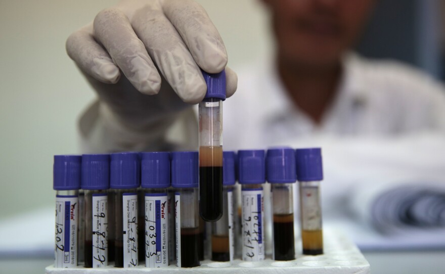 A medical worker sorts blood test samples at the National Blood Transfusion and Research Centre in Sanaa on Wednesday.