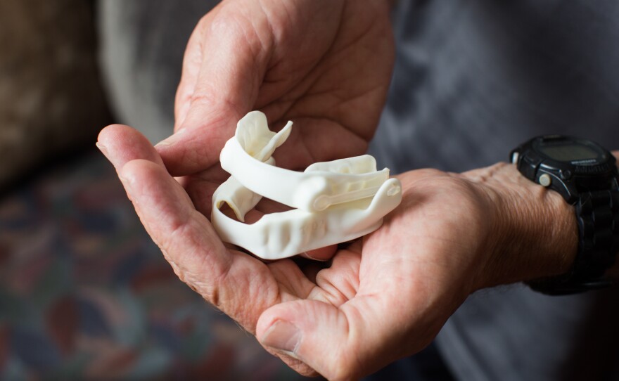 Instead of relying on forced air to keep his airway open when he sleeps, Arnott now wears this soft oral appliance at night. The device is more comfortable than CPAP, he says, and has decreased his apnea symptoms to "negligible" or "mild."
