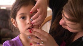 Lead: Kari Reyes (right) examines the front teeth of her four-year-old daughter, Marisa.