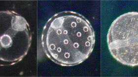 Fish egg samples as seen through a microscope.