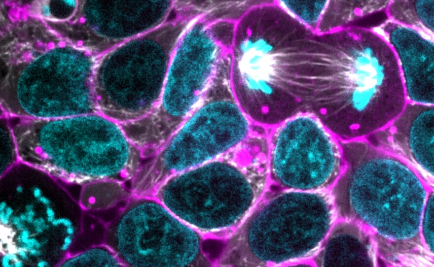 In a cluster of glowing human stem cells, one cell divides. The cell membrane is shown in purple, while DNA in the dividing nucleus is blue. The white fibers linking the nucleus are spindles, which aid in cell division.