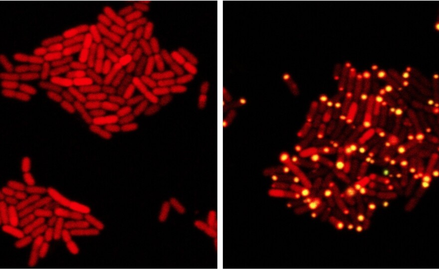In these images, E coli bacteria harbor proteins from a bacteria-killing virus that can eavesdrop on bacterial communication. At left, one protein from the virus has been tagged with a red marker. At right, the virus has overheard bacterial communication indicating the bacteria have achieved a quorum; it sends its protein to the poles of the cell (yellow dots).