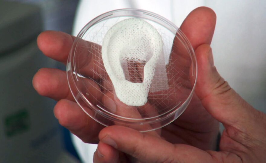 Ear scaffold. At the Wake Forest Institute for Regenerative Medicine in Winston-Salem, N.C., scientists use a specially-modified 3D printer to build structures that may one day create organs, tissues and bones for human transplant.