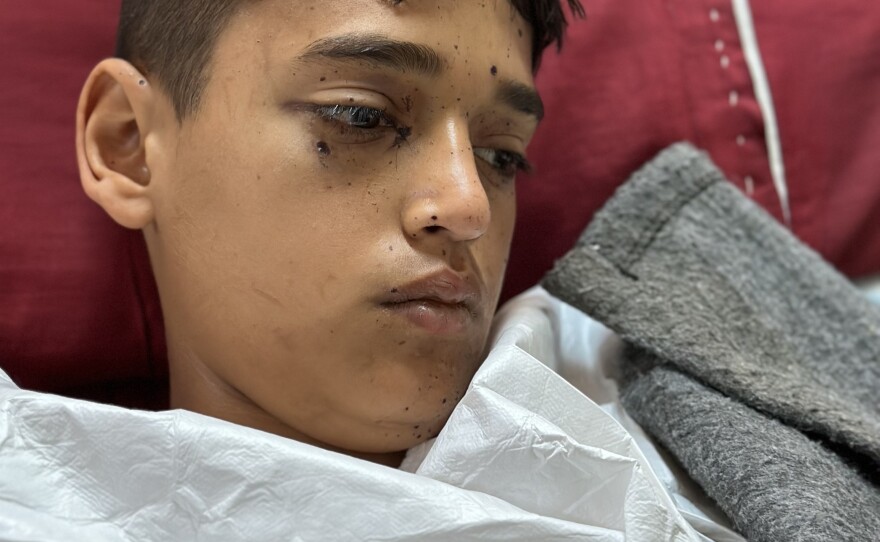 Fourteen-year-old Mohammed Abu Samur found what he thought was a bottle of perfume or deodorant. He lost his left hand below the elbow, and all the fingers on his right hand.