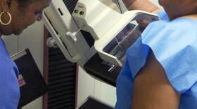 For women who carry certain genes, getting a double mastectomy before anything shows up on a mammogram may reduce breast and ovarian cancer risk.