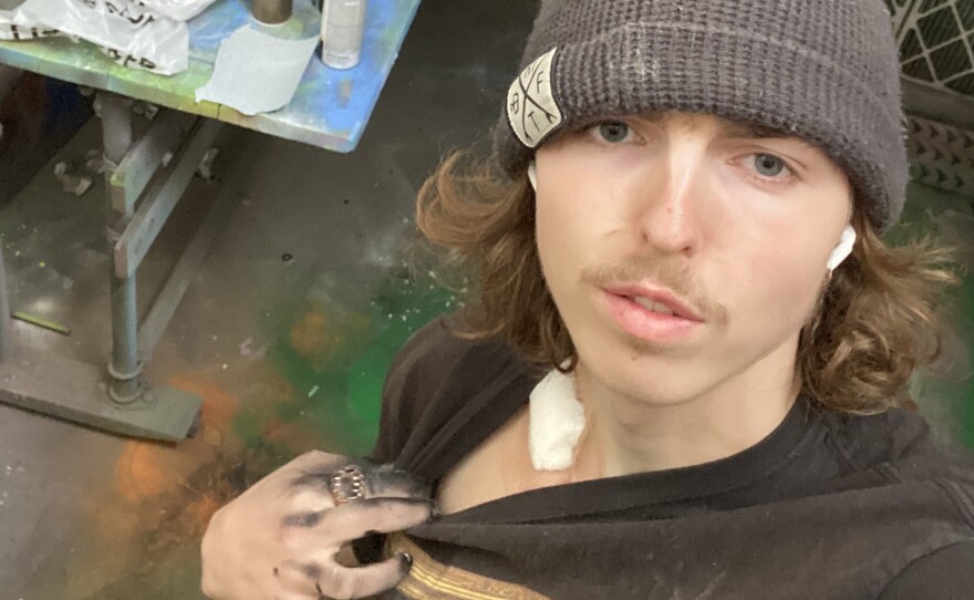 Less than 24 hours after having a tube inserted into his heart, Chivers was back to work on a sculpture for school.