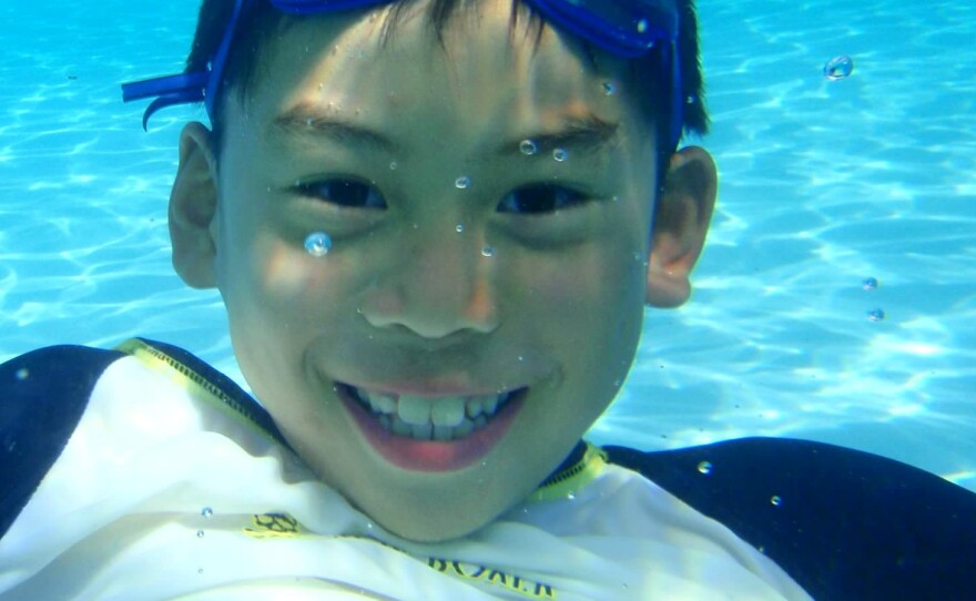 Joey in July 2013, after his diagnosis.