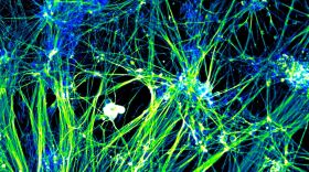 Neurons derived from the skin cells of Parkinson’s disease patients at The Scripps Research Institute, shown in an undated photo. 