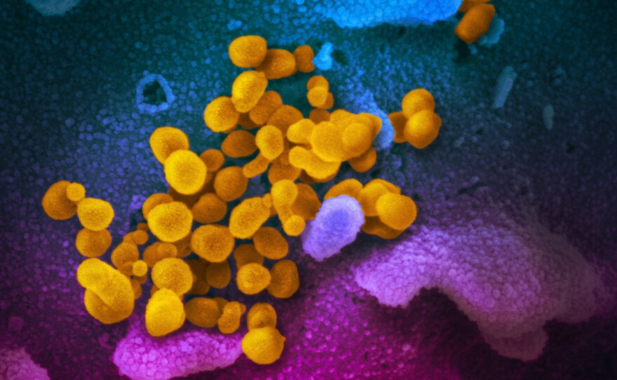The coronavirus that causes COVID-19 is seen in yellow, emerging from cells (in blue and pink) cultured in the lab. This image is from a scanning electron microscope.
