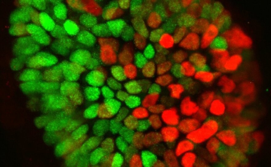 Using embryonic stem cells, researchers created a structure that mimics the earliest stages of human development in the womb. This image shows the structure breaking the symmetry of the sphere, which starts the development of more complex structures that eventually develop into a fetus.