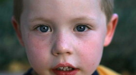 Four-year-old DJ is currently taking a mixture of behavior-modifying medications.