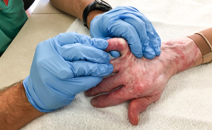 Therapists spend much of their time stretching patients to keep them limber as they heal.