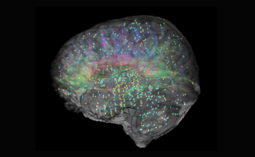 An image from the Allen Institute's Brain Explorer shows gene expression across the human brain.