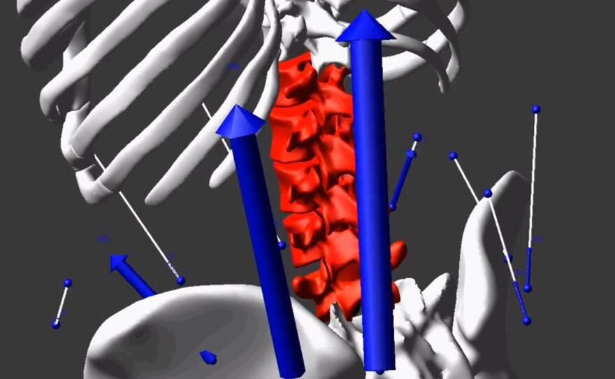 In this close-up screenshot from a simulation video, you can see the exact moment NPR correspondent Daniel Zwerdling endured dangerous levels of stress on his spine while re-creating the way nurses push their patients in a lift chair. The blue arrows show the high magnitude and distribution of forces from his muscles, while the red indicates the high level of forces on his disks.