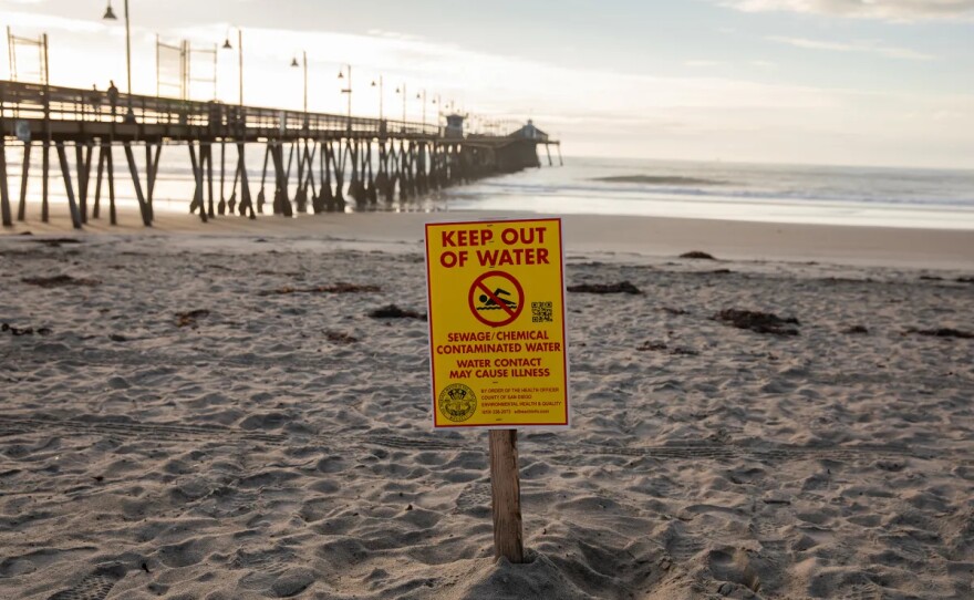 A warning sign about sewage and chemical contamination is posted along the shore of Imperial Beach on Nov. 21, 2025.