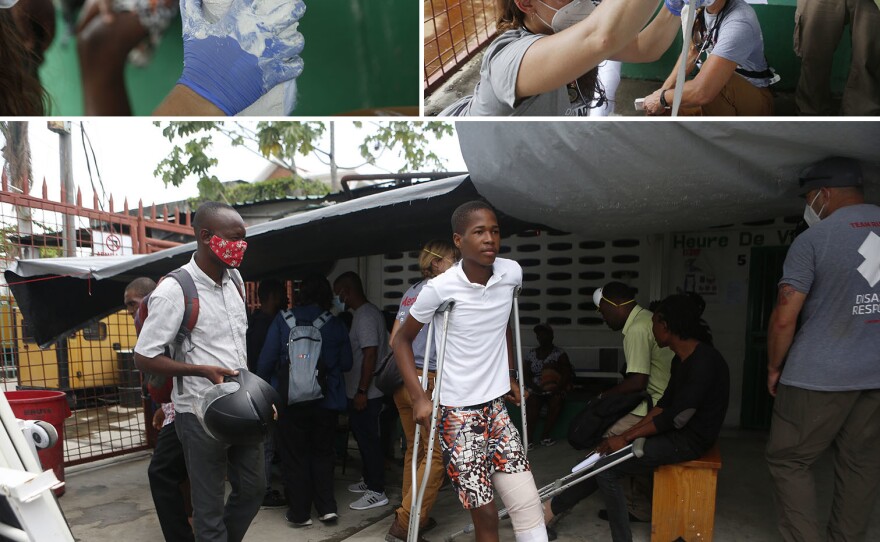 Kendy Cazeau prepares to go home after getting a cast for his broken leg.
