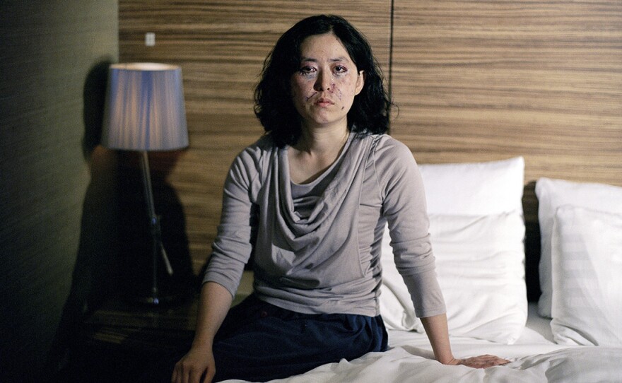 Photographer Ji Yeo took portraits of women in South Korea recovering from plastic surgeries.