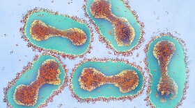 Smallpox virus, colorized and magnified in this micrograph 42,000 times, is the real concern for biologists working on a cousin virus — horsepox. They're hoping to develop a better vaccine against smallpox, should that human scourge ever be used as a bioweapon.