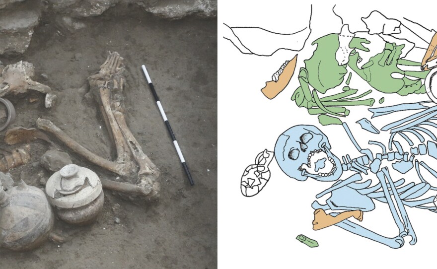 Some 3500 years ago, two brothers were buried alongside one another. Once excavated, their skeletons revealed numerous anomalies. The remains of the older brother are colored blue and those of the younger brother are colored green.