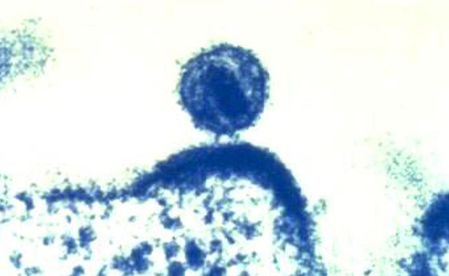 A colorized electron microscope image from the National Institute of Allergy and Infectious Diseases shows a single human immunodeficiency virus budding from a human immune cell, which the virus had infected.