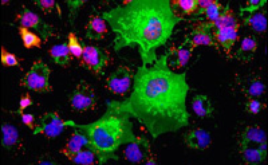 Fluorescent "tags" reveal how some cancer cells (blue) are making more of a specific protein (green).