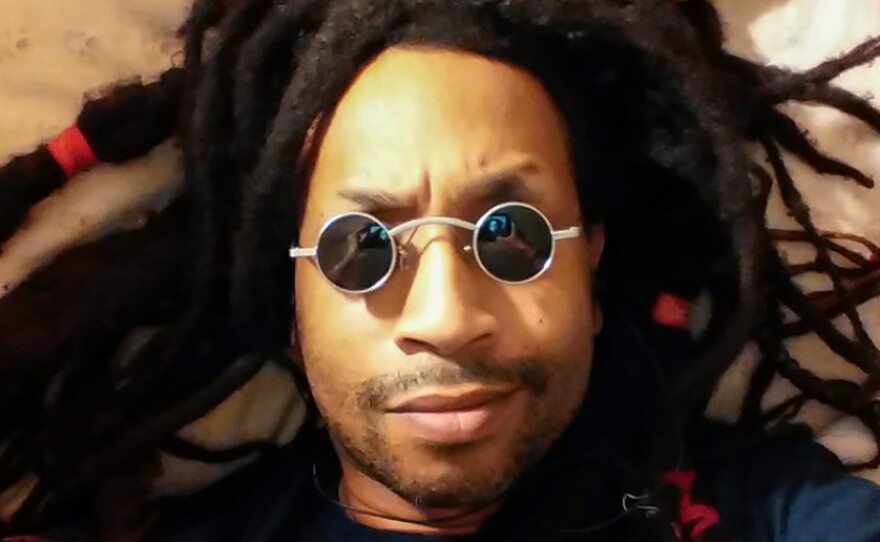 Casanova Frankenstein started wearing dark glasses as a defense against bullies. That was decades ago. But he's still wearing them.