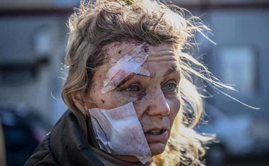 A wounded woman stands outside a hospital after the bombing of the eastern Ukraine town of Chuguiv on Feb. 24, 2022.