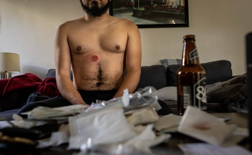 Freelance photographer Christian Monterrosa made a photo of himself after being hit with a rubber bullet by the police.