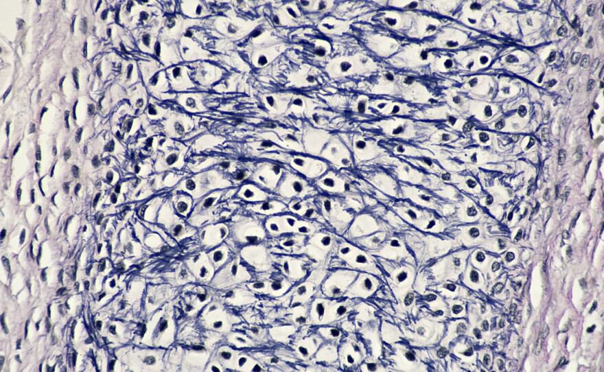 Human fetal tissue (stock photo)