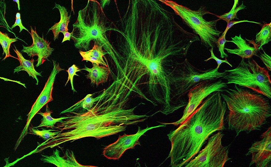 Astrocyte cells like these from the brain of a mouse may differ subtly from those in a human brain.
