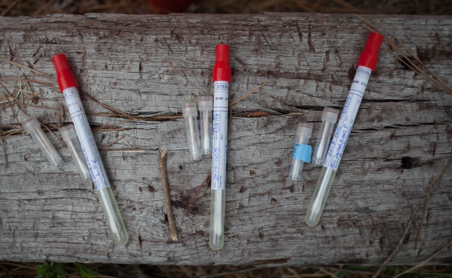 Researchers used cotton swabs to sample bacteria and other microbes from the skin of donated corpses placed in a field in Huntsville, Texas.