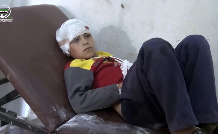 A child with a bandaged head lies in a hospital bed after deadly airstrikes Wednesday in the northern, rebel-held village of Hass, Syria.