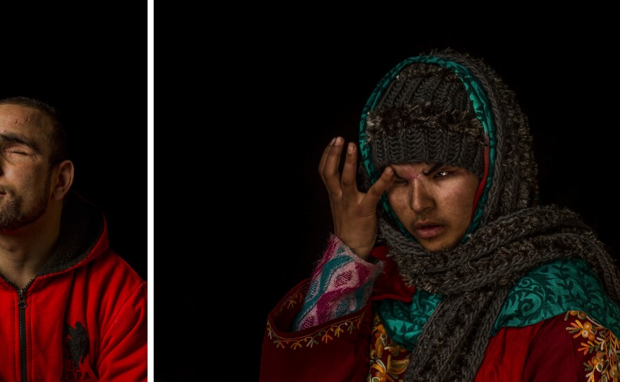 Danish Rajab Jhat (left) and Insha Mushtaq Malik (right), both pictured here in Sedow, Kashmir, in 2016, each lost the vision in one of their eyes after they were hit by shotgun pellets fired by the Indian military. Thousands of Kashmiris have lost eyesight due to pellet attacks by the Indian military.