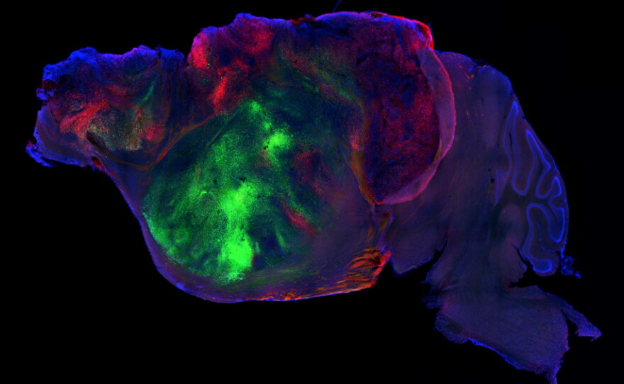 This side view of a lab mouse brain shows nerve fibers extending from the human graft (colored with green and red fluorescent proteins) through the mouse brain (colored with blue). Scale bar = 1 mm.