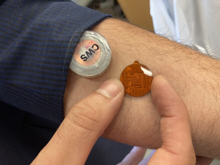 In this photo the working monitor is seen left of a model of smaller model on a man's arm. Partners of startup company <br/>AquilX want to make the device smaller before it goes on the market. May 6, 2022<br/>