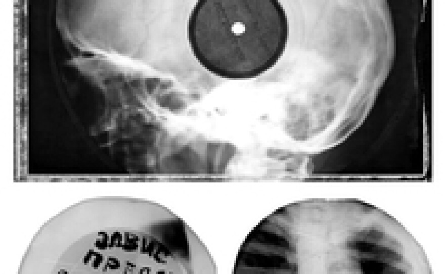 During the 1950's, with vinyl scarce, Russians began recording rock n' roll, jazz, and boogie woogie on used x-rays that they gathered from hospitals and doctors offices. They would cut a crude circle out with manicure scissors, use a cigarette to burn a hole.