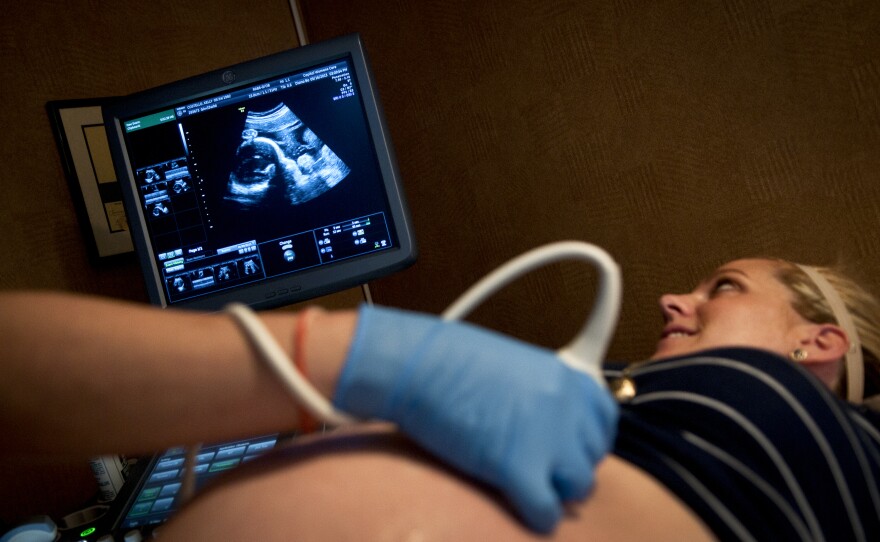 Costello receives an ultrasound at a local health clinic in Silver Spring, Md. The couple are expecting twins, a boy and a girl, before June's end.