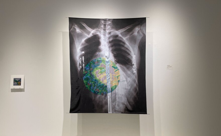 A large silk cloth is printed with a black and white X-ray of ribs and a curved spine with two metal rods. Colorful round embroidery in greens, blues, yellows and brownish-pinks covers part of the ribcage and the rods. Subtle topographic lines cover the contours of the bones and other features in the X-ray.