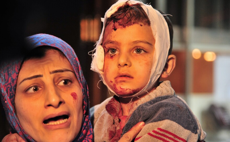 A woman carries a child injured in a triple blast a suburb of the Syrian capital Damascus on Feb. 21.