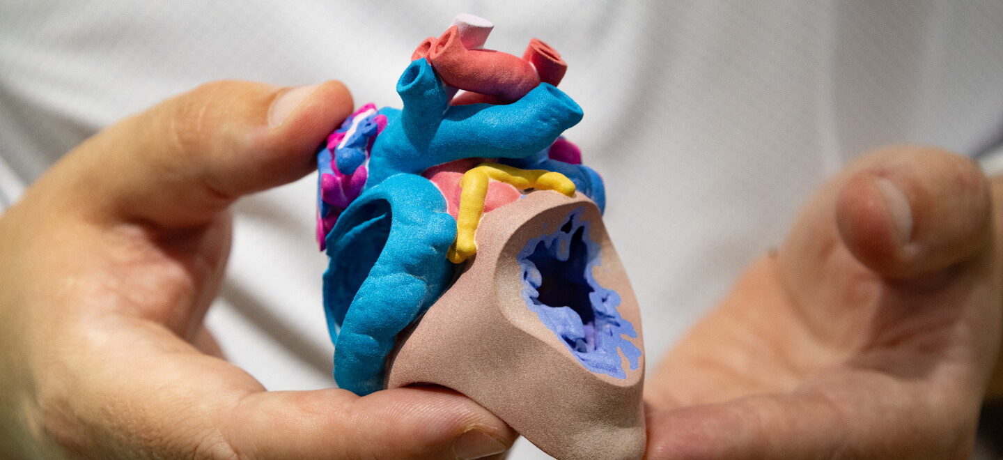 Justin Ryan holds a patients heart model. The heart has a hole in it, a common birth defect. These models are used in surgical planning. 