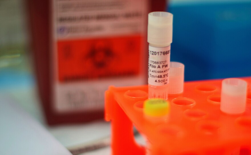 Some blood plasma samples collected from Ebola patients in West Africa also contained GB Virus-C.