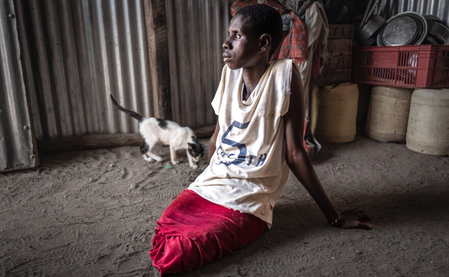 Ng'ikalei Loito, who lost her legs to a crocodile attack in August 2025, photographed at the home of a friend in Kalokol on the shores of Lake Turkana in northern Kenya. Loito was bathing near the shore when she was attacked. Rescuers found her clinging to a submerged tree. The same year, she lost her husband in a cattle raid. Persistent drought in the region has led to increased conflict over dwindling resources, both on land and on the water, while residents say the rising lake levels have led to a spike in crocodile attacks. She had been the breadwinner for her five children and large extended family, selling tea and dough balls at the lakeshore. Now, she says, she's unable to work, and worries about how she'll be able to support her family in the future.