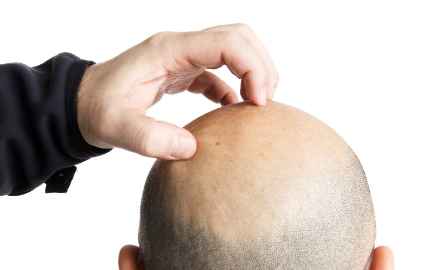 The origin of itch has confounded scientists for decades.