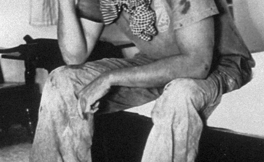 American journalist Nate Thayer sits bandaged in a hotel room on Oct. 15, 1989, in Aranyaprathet, Thailand, after he was injured in a land mine explosion. Thayer survived several brushes with death over decades covering conflict in Southeast Asia and was the last Western journalist to interview Pol Pot. He was found dead at his home in Falmouth, Mass., on Tuesday.