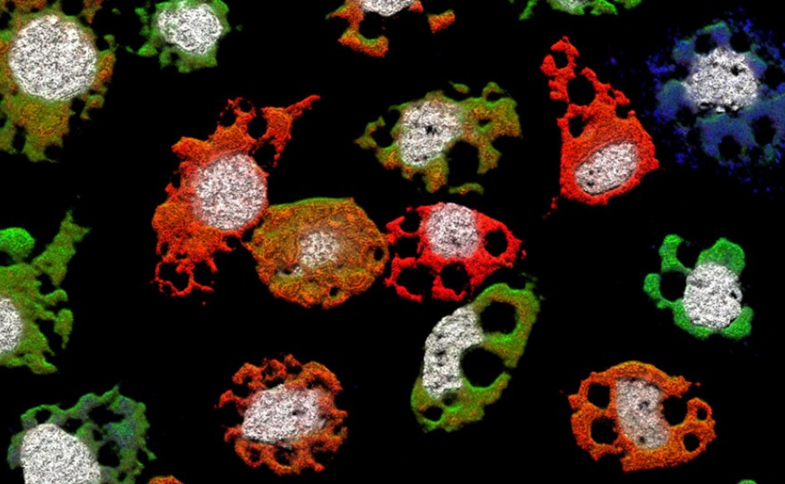 These are insect cells infected with the Guaico Culex virus. The different colors denote cells infected with different pieces of the virus. Only the brown-colored cells are infectious, because they contain the complete virus.