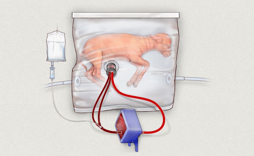 An illustration of a fetal lamb inside the "artificial womb" device, which mimics the conditions inside a pregnant animal.