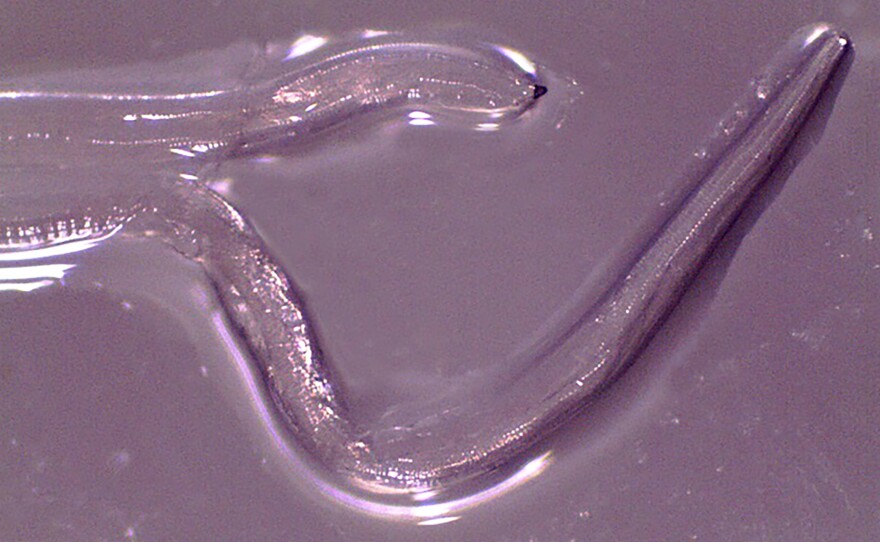 A worm species called Thelazia gulosa was found in the eye of a woman.