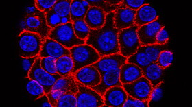 This undated microscope image from USC via the NIH shows pancreatic cancer cells, nuclei in blue, growing as a sphere encased in membranes, red.